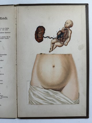 Zerlegbare Modelle zu Dr. F. K&ouml;nig's Ratgeber [= Dissectible models accompanying Dr. F. K&ouml;nig's guide]